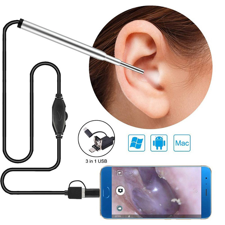 Medical Endoscope Camera Khutu Nasal Endoscope Usb Otoscope